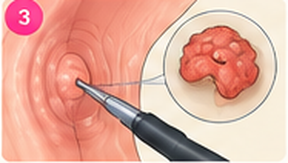 Illustration: biopsy and pathology