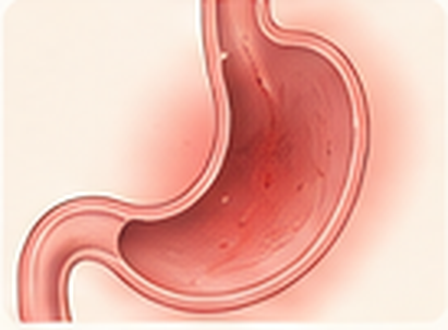 Illustration representing long-standing reflux