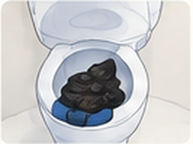 Illustration: bleeding or black stools